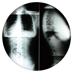 Gonstead Chiropractic X-Rays